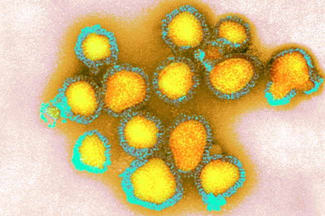 甲型H3N2流感病毒